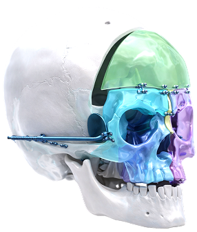 https://workshop.sobrapar.org.br/wp-content/uploads/2026/04/cranio.png
